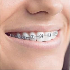 Oral B Oral-B Aufsteckbürsten Interspace, Weiß, 2 Stück -Wohnmöbel Gemischtwaren Geschäft 1f1e17c861376219614640c1721afb6013689ff7 aufsteckbuersten oral b interspace